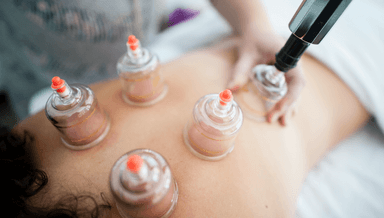 Image for Cupping massage